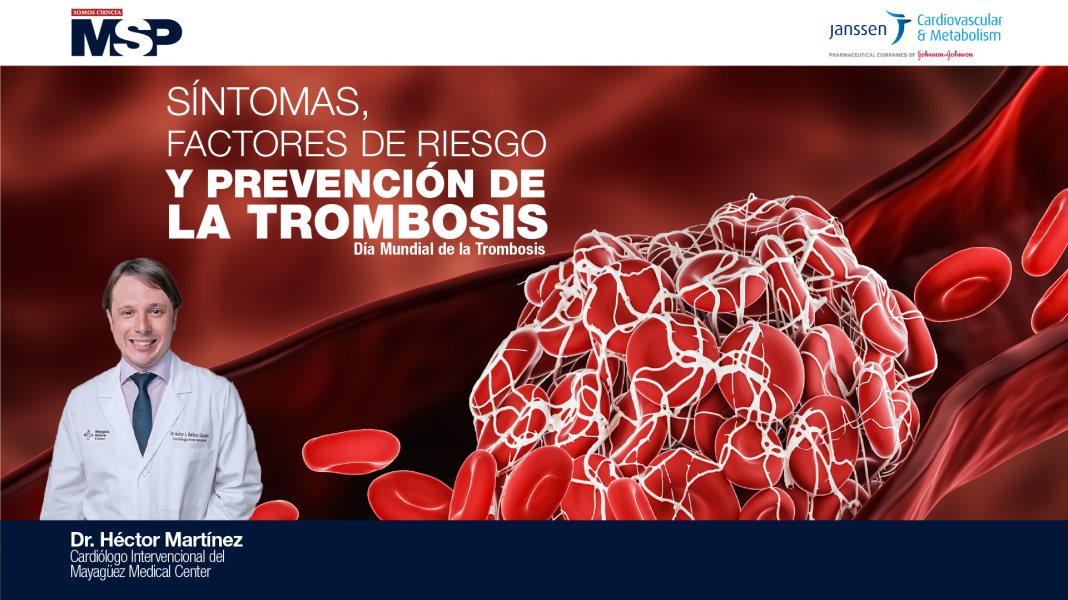 Síntomas factores de riesgo y prevención de la trombosis