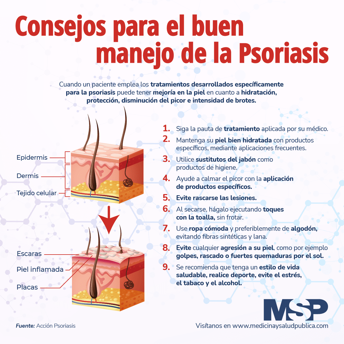 Consejos para el buen manejo de la psoriasis Infografía