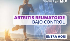 Nuevos mecanismos de acción para alcanzar remisión en Artritis Reumatoide