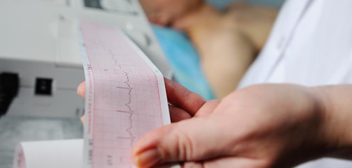El electrocardiograma de ingreso, clave para identificar el infarto