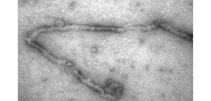 Desarrollan nuevas vacunas contra el virus del ébola