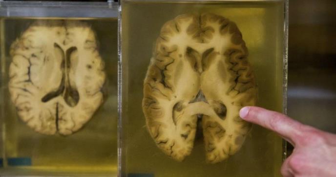 Por primera vez, logran mantener cerebros vivos fuera del cuerpo