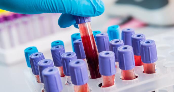 Nuevo análisis de sangre podría detectar más de 20 tipos de cáncer