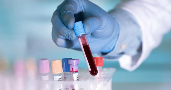 Un análisis de sangre que podría predecir el riesgo de muerte en el futuro