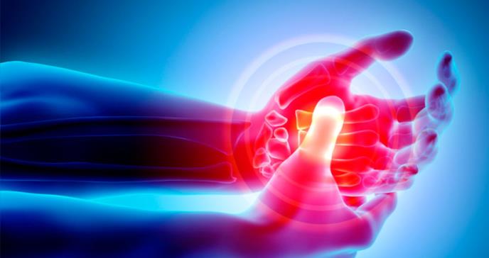 Diferencia entre la artritis reumatoide y la artritis psoriásica