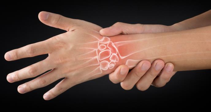 Causas y señales de alerta de la artritis reumatoide