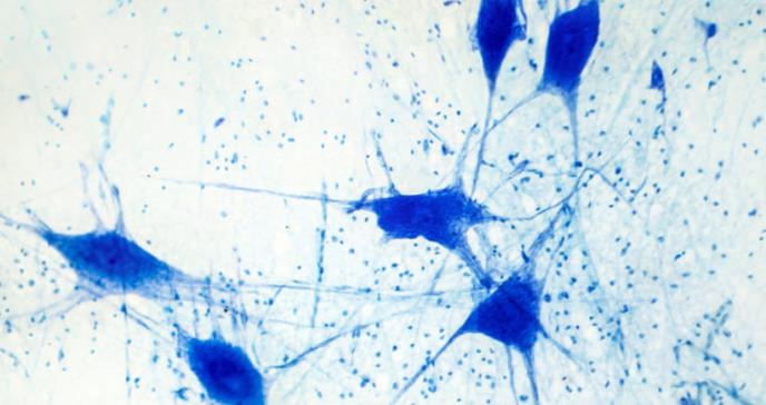Células gliales defectuosas desencadenarían la enfermedad de Parkinson
