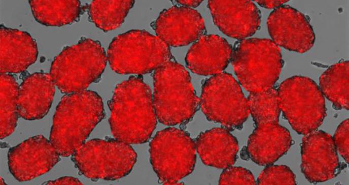Células madre, nueva esperanza para el tratamiento de diabetes