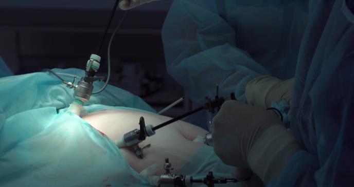 Cirugía laparoscópica para  cáncer de colon y recto: estado actual  en Puerto Rico