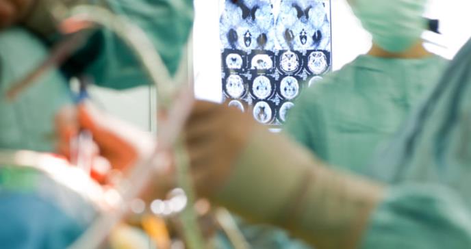 Cirugía láser en el cerebro para quemar focos epilépticos