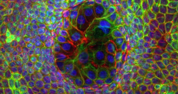 Descubren una nueva propiedad de las células: la superelasticidad