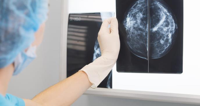 Dispositivo detectaría cáncer de mama sin radiación