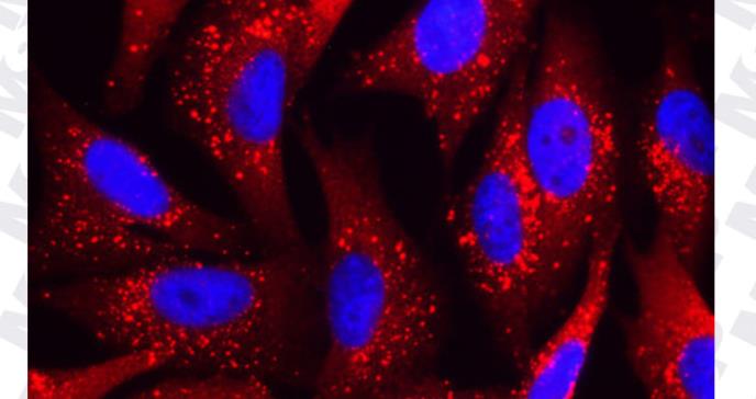 Dos proteínas comienzan a desvelar el ‘caos’ del melanoma