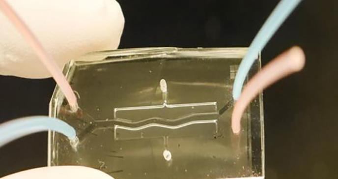 El páncreas humano en un chip para tratar la fibrosis quística