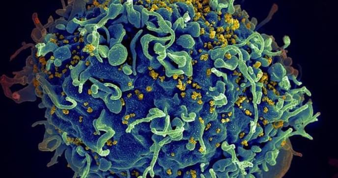 Crean nueva técnica para identificar con precisión el VIH oculto