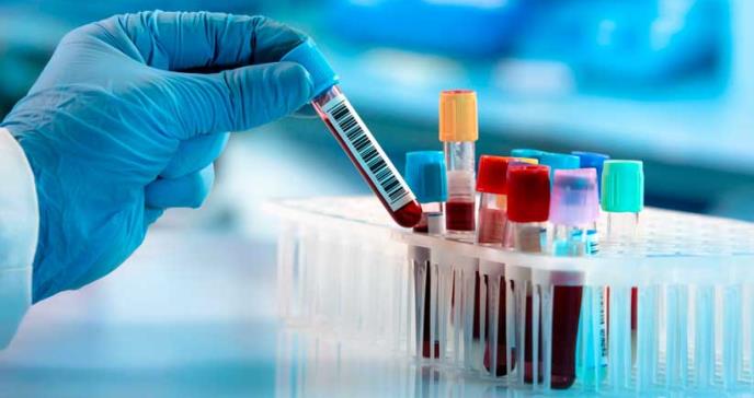 FDA autoriza primera prueba para detectar resistencia a los medicamentos contra el VIH