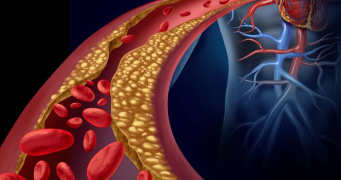 Grasas saturadas y una predisposición al origen de enfermedades cardíacas por niveles de colesterol