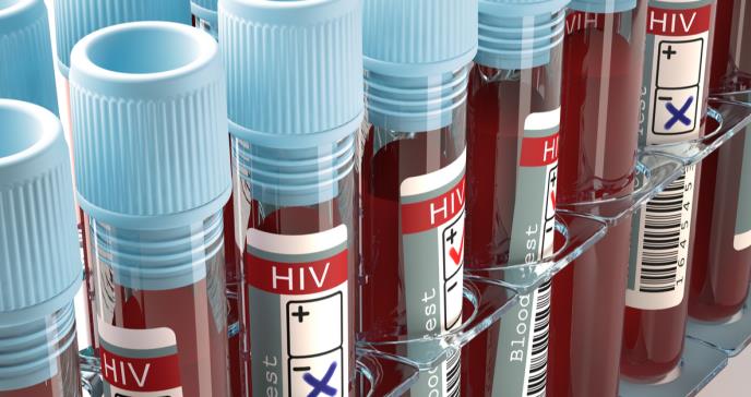 Los NIH invierten 14,6 millones de dólares en investigación que busca la cura del VIH