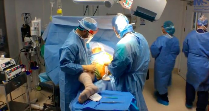 Cirugía para corregir deformación en cadera establecería precedente mundial