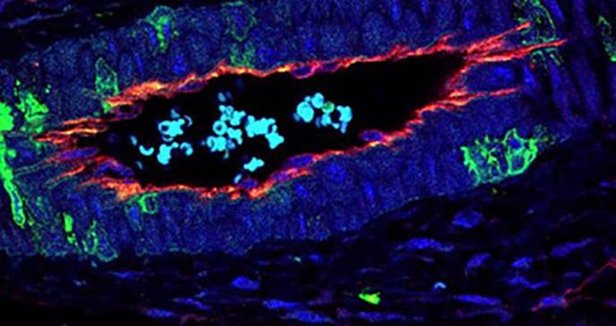 La proteína p38 regula la formación de nuevos vasos sanguíneos en tumores