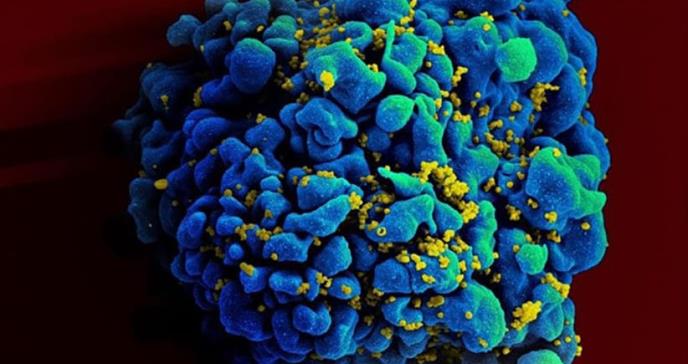 La remisión sostenida del VIH sin terapia antirretroviral, la principal prioridad en investigación