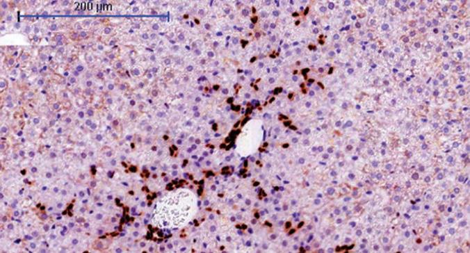 Las células madre del hígado intervienen en el desarrollo de tumores