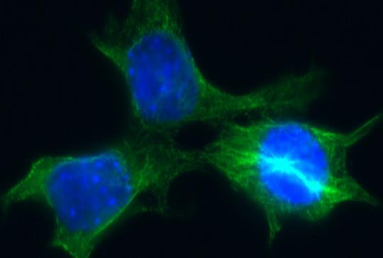 Células tumorales esquivan la muerte gracias a mecanismo de reparación del ADN