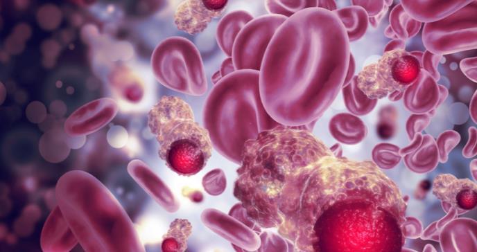 Sintomatología de COVID-19 sería más grave en pacientes con leucemia