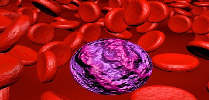 Mayor la mortalidad de la Leucemia Linfoblástica Aguda en hombres adultos