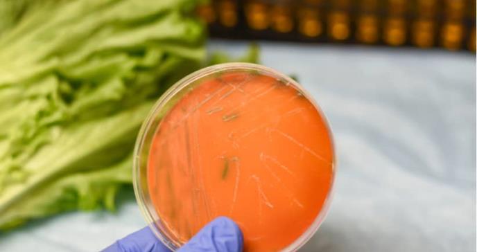 Listeria: por qué es tan peligrosa la infección por esta bacteria y cómo se puede evitar
