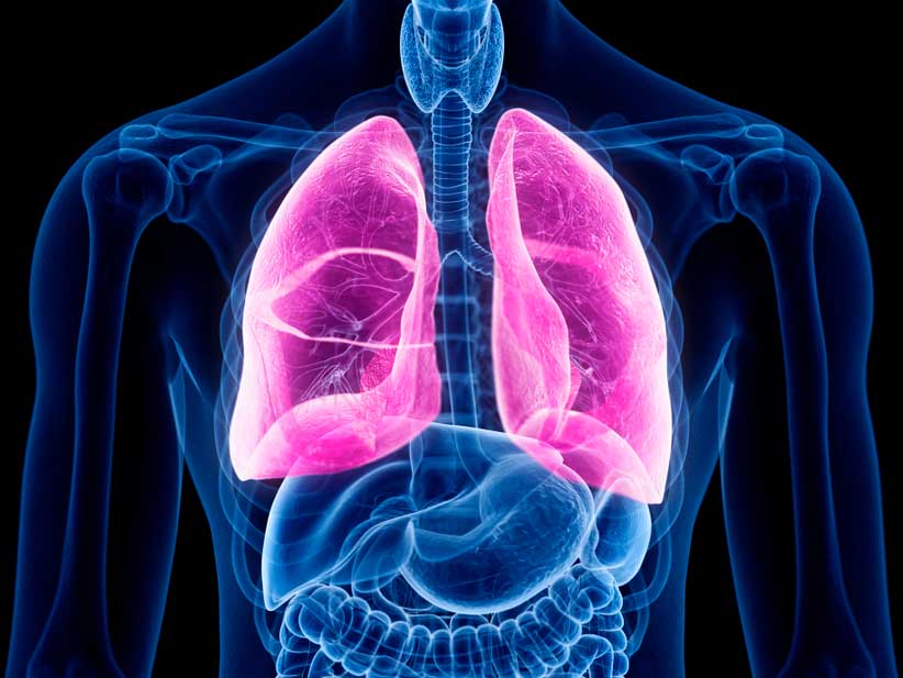 Nuevo enfoque para tratar la fibrosis quística reduciría el riesgo de  trasplantes de pulmón