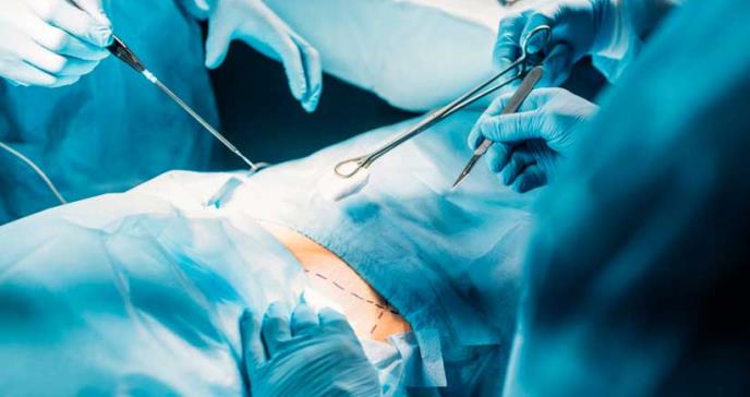 Por primera vez realizan extracción completa de pulmón mediante cirugía de ojo de cerradura