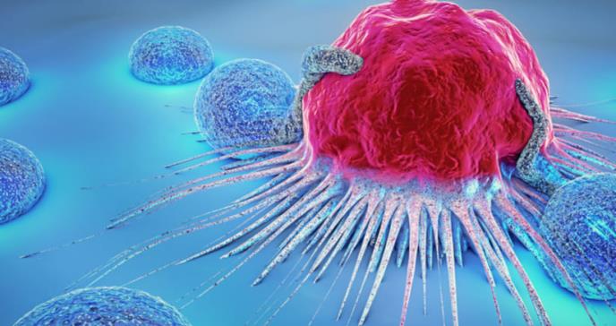 Por qué hay científicos que quieren dejar de llamar cáncer a algunos tumores