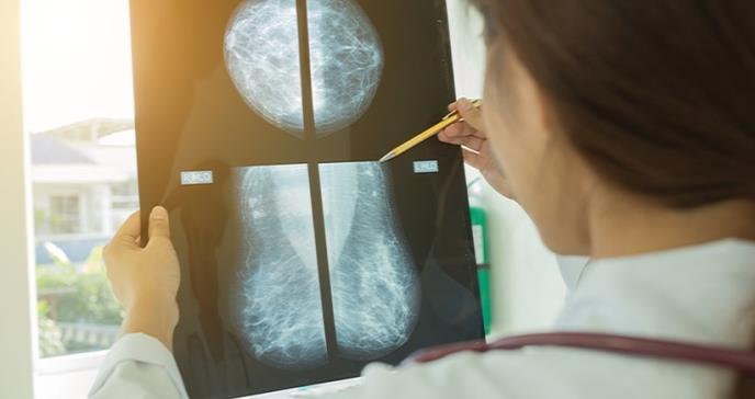 Descubren una inyección para frenar el cáncer de mama más mortal