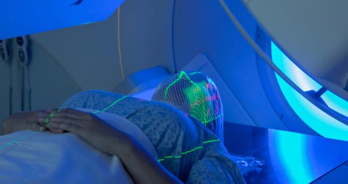 Nueva radioterapia para cáncer cerebral preservará la función cognitiva