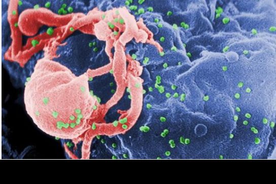 Identifican una proteína que podría facilitar el diagnóstico de VIH en países pobres
