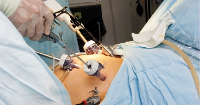 Los efectos metabólicos de la cirugía bariátrica en pacientes puertorriqueños