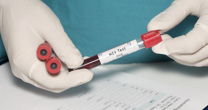 Desarrollan una prueba que permite detectar VIH oculto