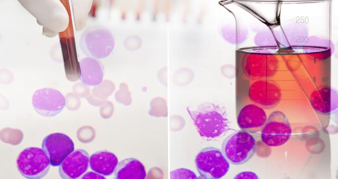 Estados Unidos aprueba la primera terapia génica contra la leucemia
