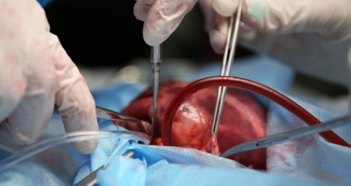 Método triplicaría la supervivencia de órganos para trasplantes