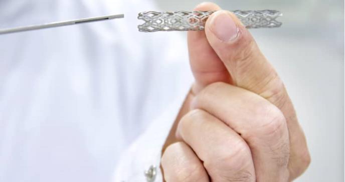 Conozca el “stent” y sus beneficios para reducir la mortalidad cardiovascular