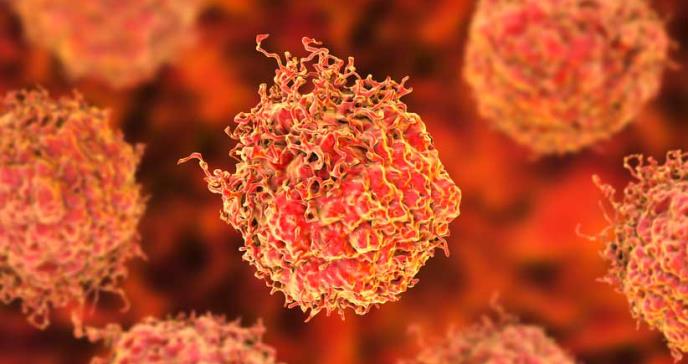 Terapia de protones reduciría el riesgo de efectos secundarios en el cáncer
