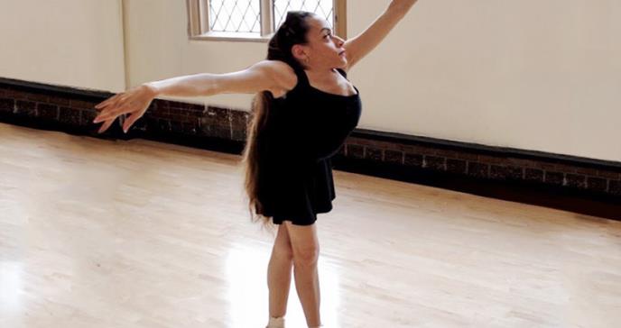 La impresionante historia de la bailarina que padece el síndrome Jarcho Levin