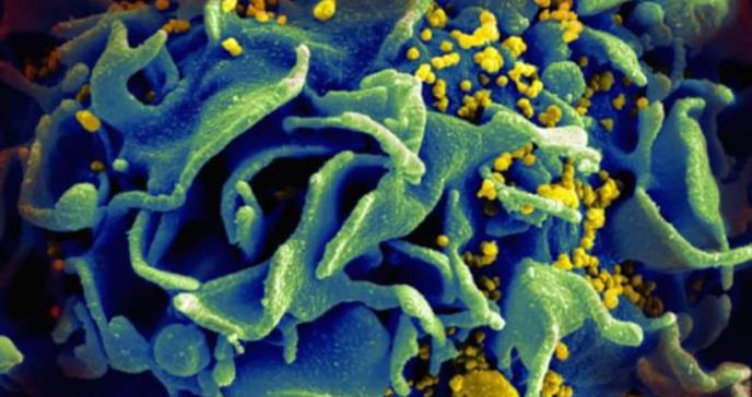 Un anticuerpo suprime el virus del sida en pacientes hasta cuatro meses sin tratamiento