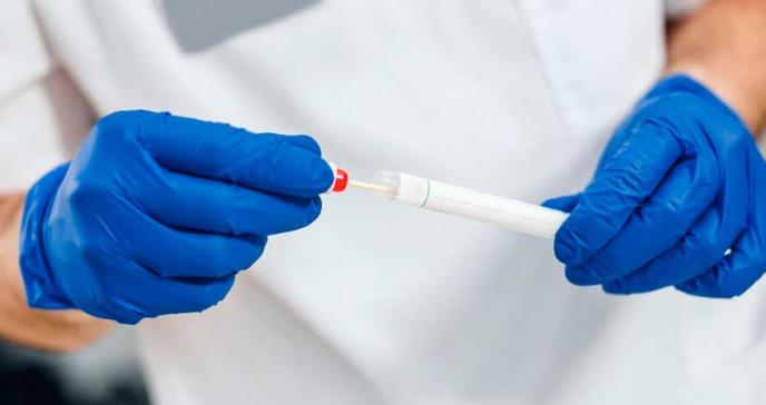 Un test de saliva permite la detección precoz del cáncer de boca y cuello