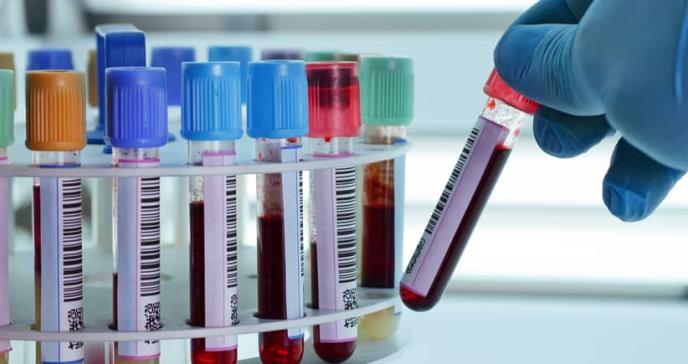 Un test de sangre detecta siete tipos de cáncer con una única muestra