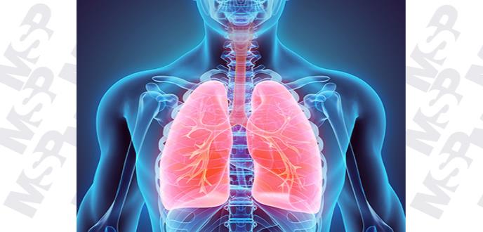 Una función pulmonar baja puede aumentar el riesgo de muerte prematura