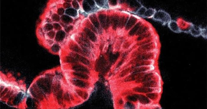 Innovadora técnica muestra el cáncer de páncreas en 3D y da pistas sobre su origen