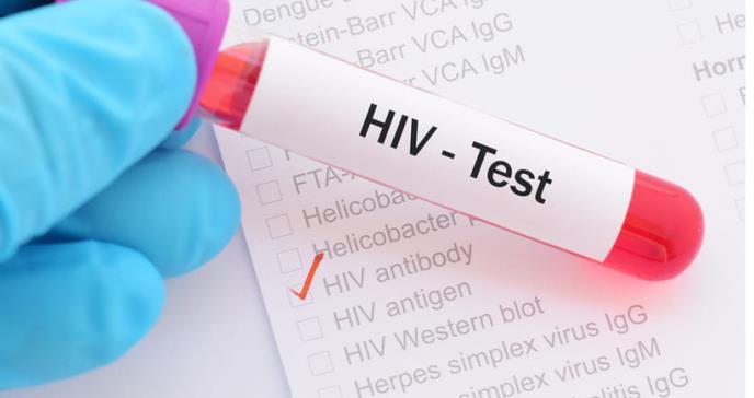 Confirman segundo paciente curado del VIH