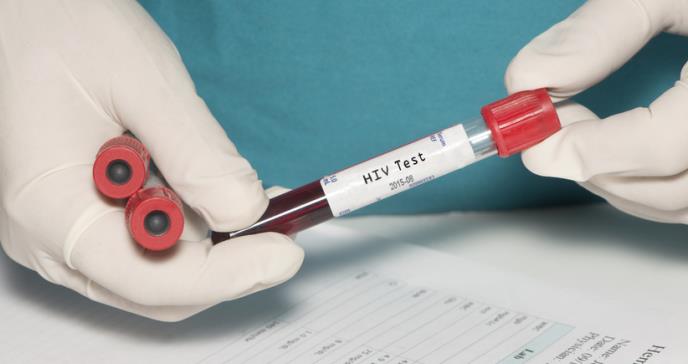 Vacuna contra el VIH en fase 3 tras muchos años de estudio